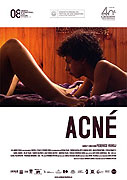 Acné – plakát filmu