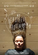 Můj nádherně porouchaný mozek – plakát filmu